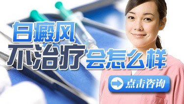 白癜风不治疗自己会好吗