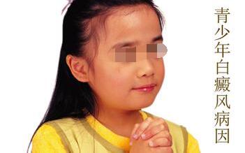 青少年白癜风是什么原因导致的