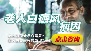 老年人患白癜风的因素有哪些
