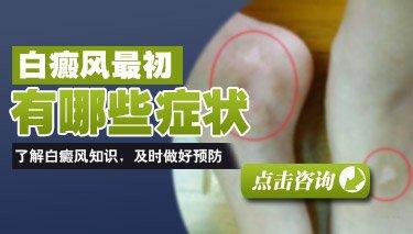白癜风的症状图片