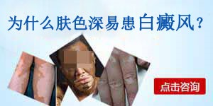白癜风是怎么得的