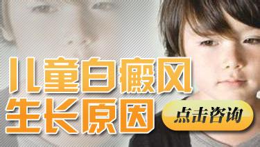 儿童患上白癜风该怎么办