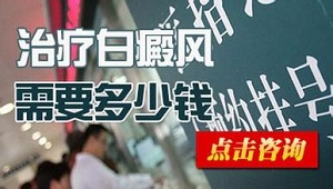 白癜风做激光治疗是怎么收费的呢?