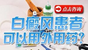 直接用药物能治疗白癜风吗?