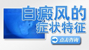 寻常型白癜风有什么特点?