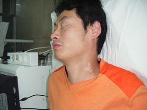 男人脸上长白癜风影响结婚吗?