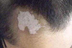 ¶îÍ·°×°ß¿ìºÃÁË»áÓÐÊ²Ã´ÌØÕ÷?