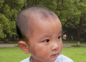 孩子出现白癜风,情绪多变,家长该怎么办?