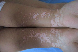 怕春节过年回家各种尴尬,因为面子走丢了