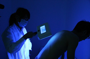 uvb光疗仪治疗白癜风效果好不好