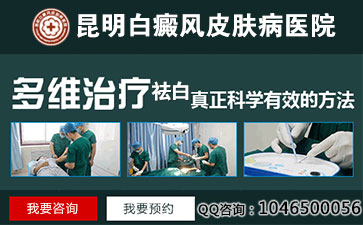 云南白癜风什么症状我们需知道