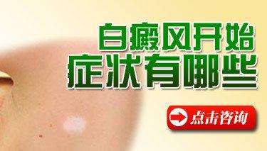 昆明不同时期白癜风有什么表现